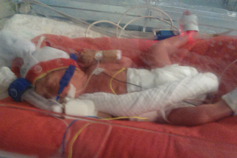 Baby Alexis in hospital, in ICU